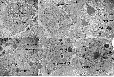 LncSSBP1 Functions as a Negative Regulator of IL-6 Through Interaction With hnRNPK in Bronchial Epithelial Cells Infected With Talaromyces marneffei